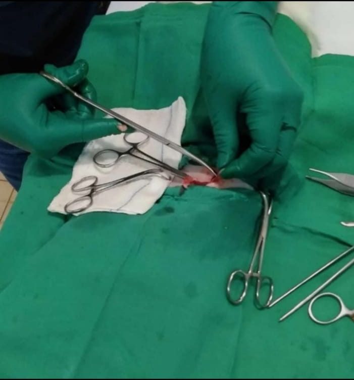 Surgical procedures